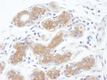 Rabbit anti-ALIX Antibody