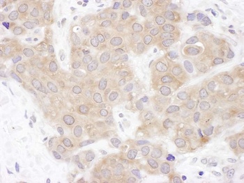 Rabbit anti-VCIP135 Antibody