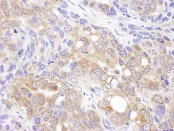 Rabbit anti-VCIP135 Antibody