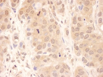 Rabbit anti-USP8 Antibody