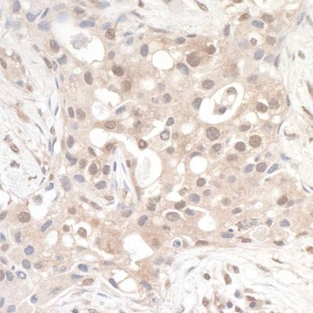 Rabbit anti-RABGEF1 Antibody