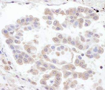 Rabbit anti-RABGEF1 Antibody