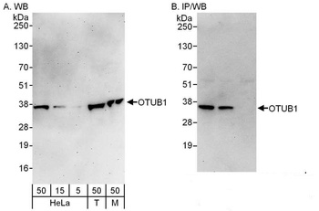 Rabbit anti-OTUB1 Antibody