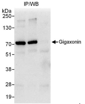 Rabbit Gigaxonin Antibody