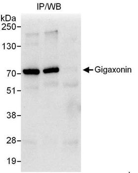 Rabbit Gigaxonin Antibody