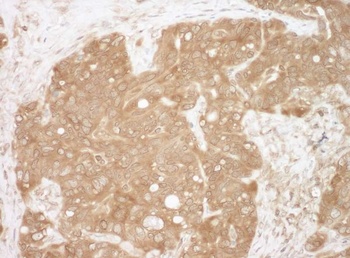 Rabbit anti-CacyBP Antibody