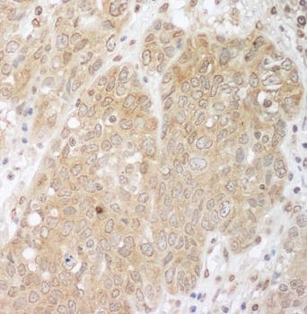 Rabbit anti-Cbl-b Antibody