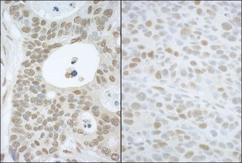 Rabbit anti-CAND1 Antibody