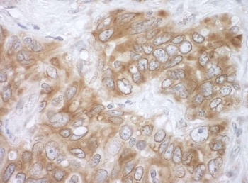 Rabbit anti-VAPB Antibody