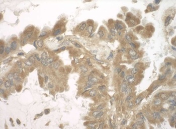 Rabbit anti-SND1 Antibody