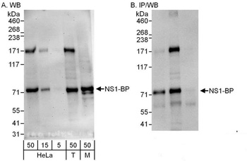 Rabbit NS1-BP Antibody