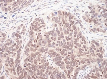Rabbit MAX Antibody