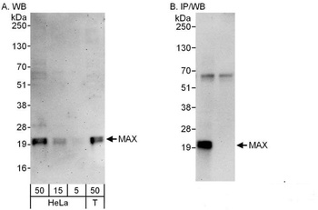 Rabbit MAX Antibody