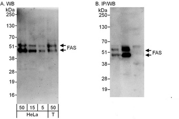 Rabbit anti-FAS Antibody