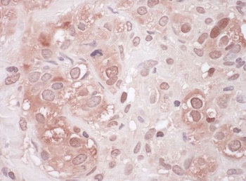 Rabbit Sequestosome-1 Antibody