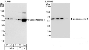 Rabbit Sequestosome-1 Antibody
