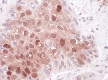 Rabbit Sequestosome-1 Antibody