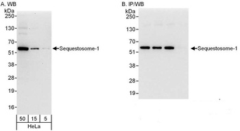 Rabbit Sequestosome-1 Antibody