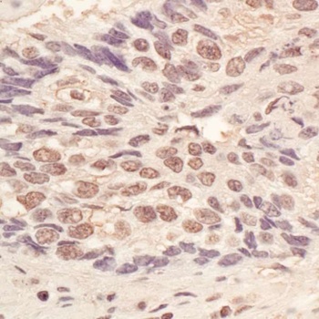 Rabbit anti-L3MBTL3 Antibody
