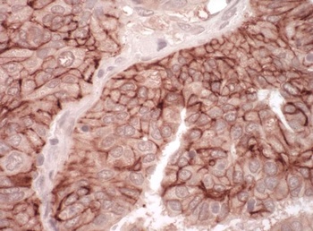 Rabbit anti-CAR Antibody