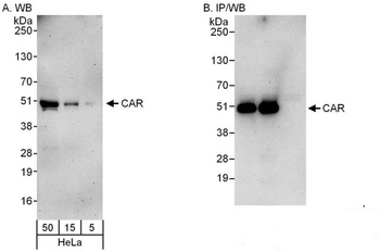Rabbit CAR Antibody