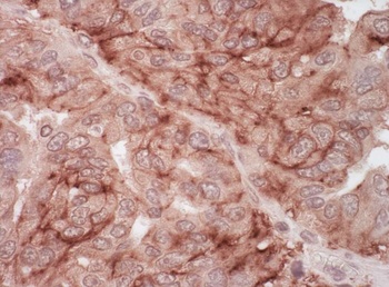 Rabbit anti-CAR Antibody
