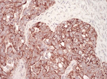 Rabbit anti-HSP60 Antibody