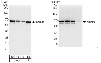 Rabbit anti-HSP60 Antibody