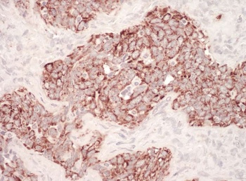 Rabbit anti-HSP60 Antibody