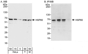 Rabbit anti-HSP60 Antibody