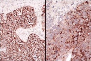 Rabbit anti-HSP60 Antibody