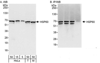 Rabbit anti-HSP60 Antibody