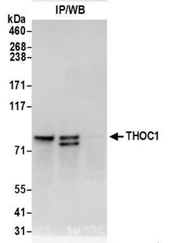 THOC1 Antibody