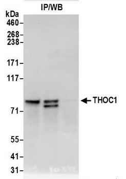 Rabbit anti-THOC1 Antibody
