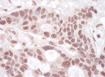 Rabbit anti-THOC1 Antibody