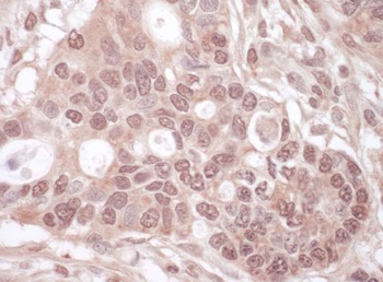 Rabbit anti-THOC1 Antibody