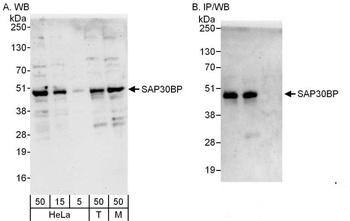Rabbit SAP30BP Antibody
