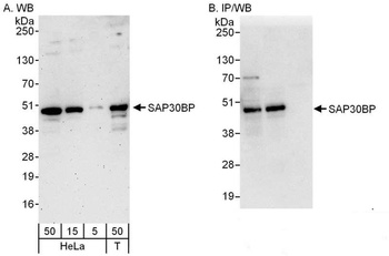 Rabbit SAP30BP Antibody