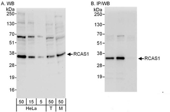 Rabbit RCAS1 Antibody