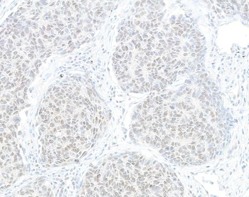 Rabbit anti-HJURP Antibody