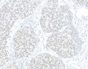 HJURP Antibody