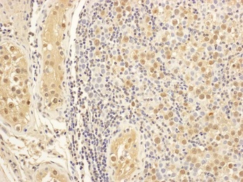 Rabbit anti-MAP1S Antibody