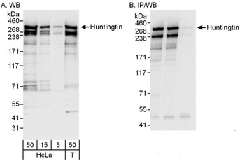 Rabbit anti-Huntingtin Antibody