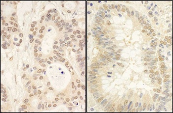 Rabbit anti-FAF1 Antibody