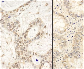 Rabbit anti-FAF1 Antibody