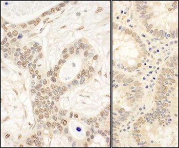 FAF1 Antibody