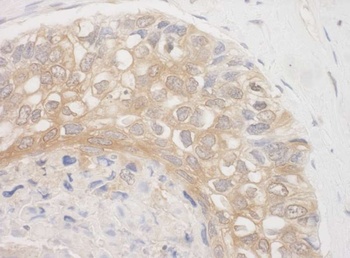 Rabbit BAG3 Antibody