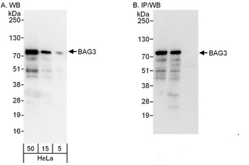 Rabbit BAG3 Antibody