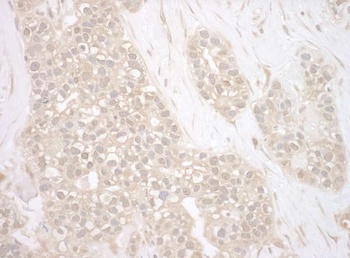 Rabbit BAG3 Antibody