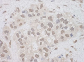 Rabbit anti-SUPT7L Antibody